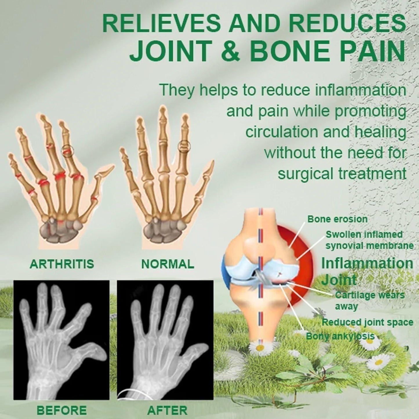 Bee Venom Joint and Bone Therapy Cream {Fast Relief} (Pack of 3)